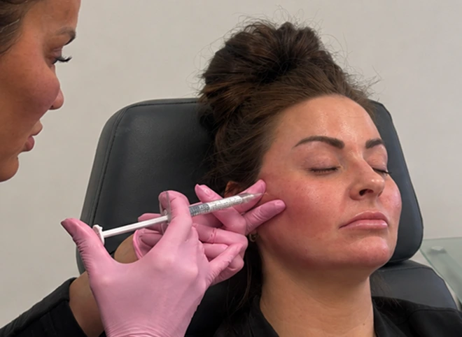 Provider injecting Belotero Balance filler into a patient's cheek