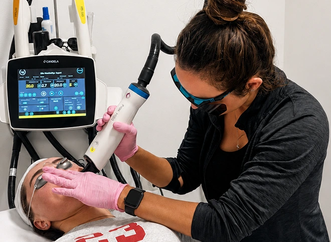 Provider performing fractional laser skin resurfacing on a patient's face