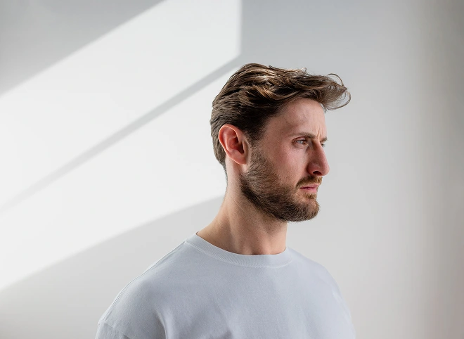 Man with a full head of hair, representing HydraFacial Keravive scalp treatment