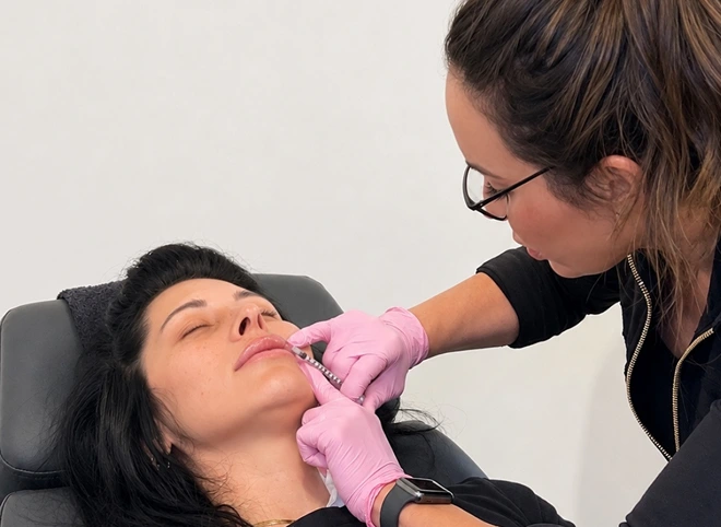 Provider injecting Juvéderm filler near a patient's lips