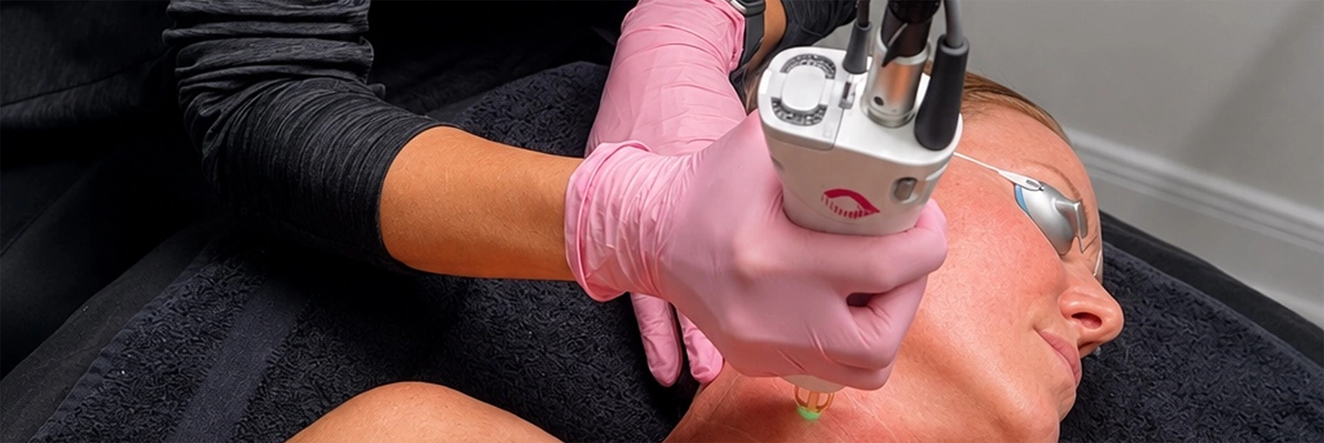 Laser skin rejuvenation treatment in Lafayette, LA