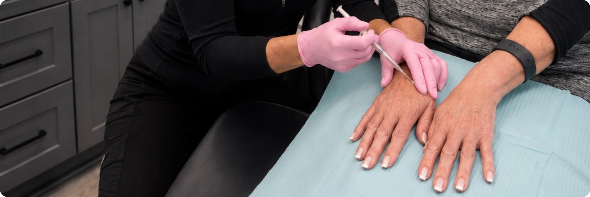 Radiesse hand rejuvenation treatment in Lafayette, LA